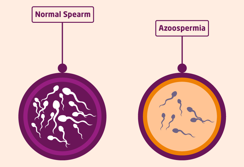 Chromosomal Evaluation