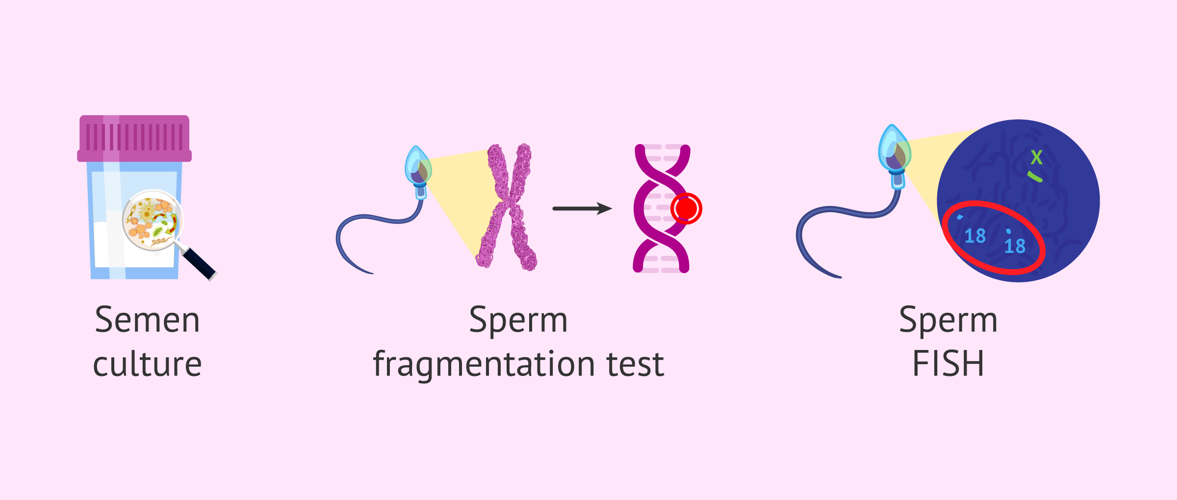 Sperm Antibody Locations - Head vs Tail