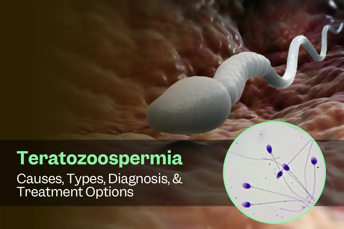 Normal vs Abnormal Sperm